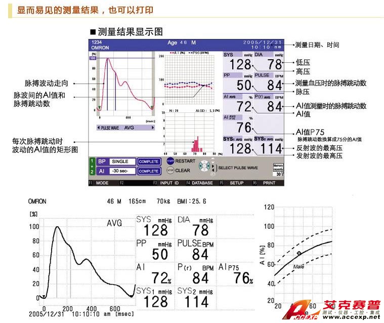 顯而易見的動脈結果